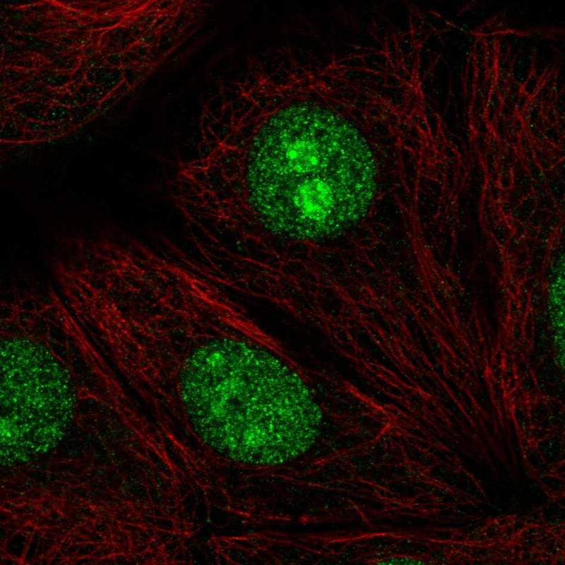 Immunocytochemistry/ Immunofluorescence - Anti-SENP3 antibody (AB247139)
