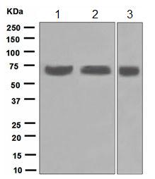 Western blot - Anti-SENP3 antibody [EP4360] (AB124790), expandable thumbnail