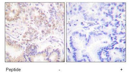 Immunohistochemistry (Formalin/PFA-fixed paraffin-embedded sections) - Anti-SENP5 antibody (AB58420)