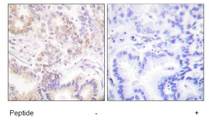 Immunohistochemistry (Formalin/PFA-fixed paraffin-embedded sections) - Anti-SENP5 antibody (AB58420)