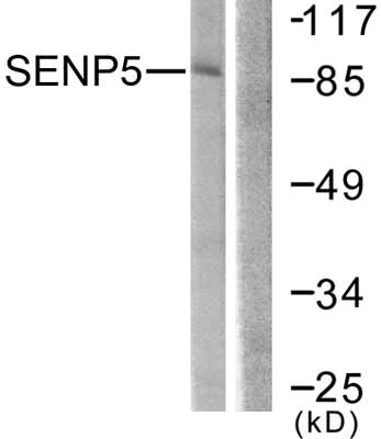 Western blot - Anti-SENP5 antibody (AB58420)