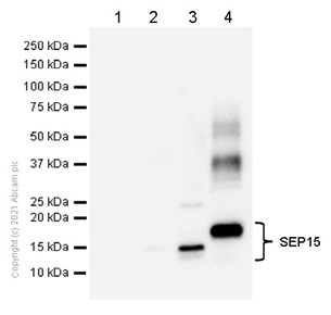 Western blot - Anti-SEP15 antibody [NCIR128A] (AB124840), expandable thumbnail