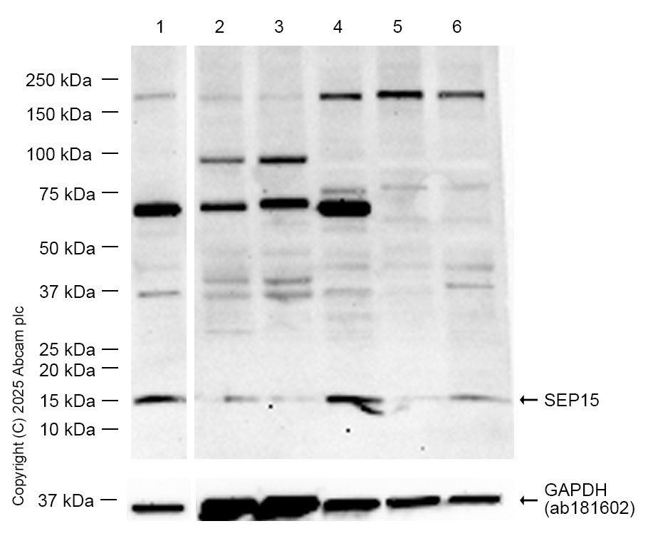 Western blot - Anti-SEP15 antibody [NCIR128A] (AB124840)