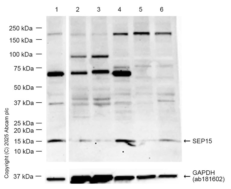 Western blot - Anti-SEP15 antibody [NCIR128A] (AB124840)