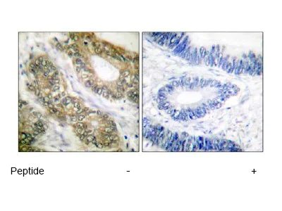 Immunohistochemistry (Formalin/PFA-fixed paraffin-embedded sections) - Anti-Separase antibody (AB52158)
