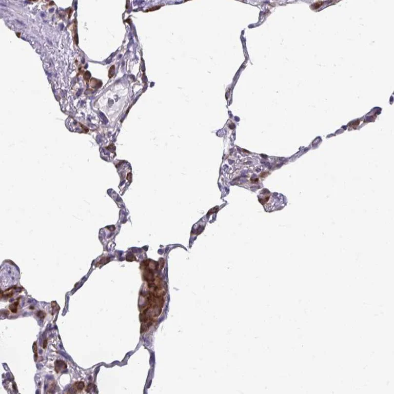Immunohistochemistry (Formalin/PFA-fixed paraffin-embedded sections) - Anti-SEPN1/SELN antibody (AB247132)