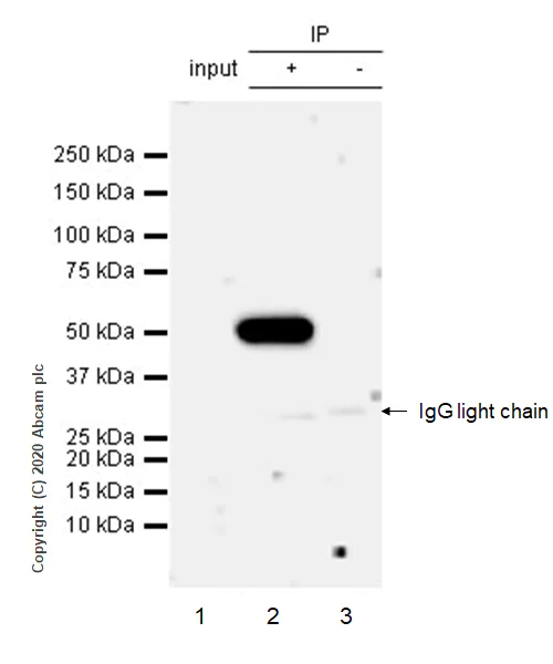 Immunoprecipitation - Anti-SEPP1 antibody [EPR24174-24] (AB277526)
