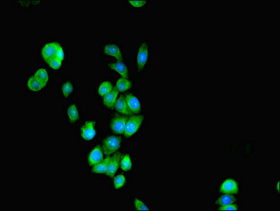 Immunocytochemistry/ Immunofluorescence - Anti-SEPSECS antibody (AB236956), expandable thumbnail
