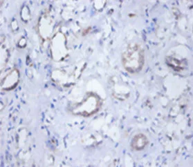 Immunohistochemistry (Formalin/PFA-fixed paraffin-embedded sections) - Anti-SEPSECS antibody (AB236956)