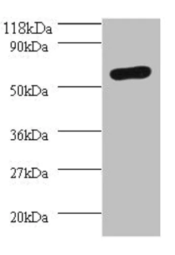 Western blot - Anti-SEPSECS antibody (AB236956)