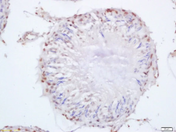 Immunohistochemistry (Formalin/PFA-fixed paraffin-embedded sections) - Anti-SEPT14 antibody (AB213160)