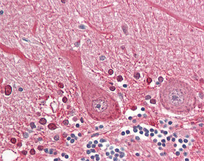 Immunohistochemistry (Formalin/PFA-fixed paraffin-embedded sections) - Anti-SEPT4 antibody (AB166788), expandable thumbnail