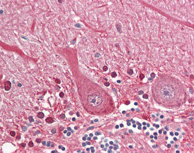Immunohistochemistry (Formalin/PFA-fixed paraffin-embedded sections) - Anti-SEPT4 antibody (AB166788)