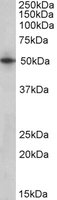 Western blot - Anti-SEPT4 antibody (AB166788), expandable thumbnail