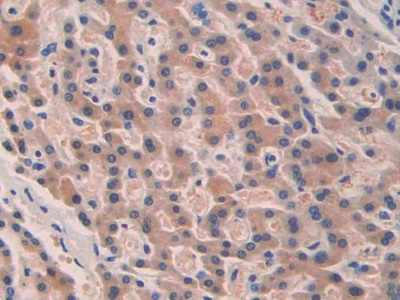 Immunohistochemistry (Formalin/PFA-fixed paraffin-embedded sections) - Anti-SEPT5 antibody (AB233431), expandable thumbnail