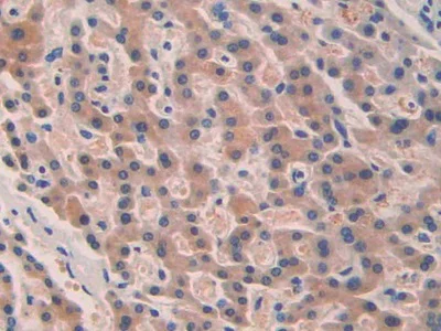 Immunohistochemistry (Formalin/PFA-fixed paraffin-embedded sections) - Anti-SEPT5 antibody (AB233431)