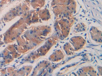 Immunohistochemistry (Formalin/PFA-fixed paraffin-embedded sections) - Anti-SEPT5 antibody (AB233431), expandable thumbnail