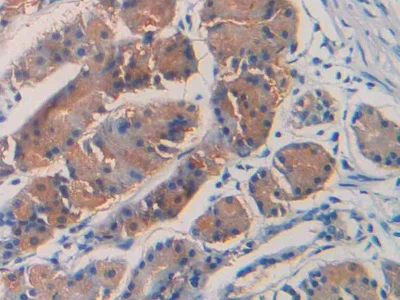 Immunohistochemistry (Formalin/PFA-fixed paraffin-embedded sections) - Anti-SEPT5 antibody (AB233431)