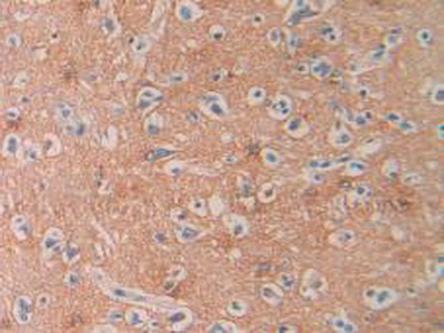 Immunohistochemistry (Formalin/PFA-fixed paraffin-embedded sections) - Anti-SEPT5 antibody (AB233431), expandable thumbnail