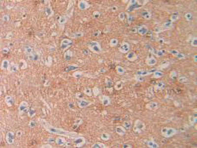 Immunohistochemistry (Formalin/PFA-fixed paraffin-embedded sections) - Anti-SEPT5 antibody (AB233431)