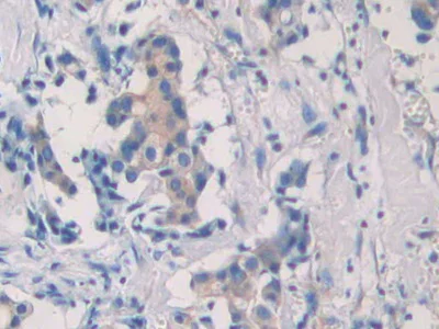 Immunohistochemistry (Formalin/PFA-fixed paraffin-embedded sections) - Anti-SEPT5 antibody (AB233431)