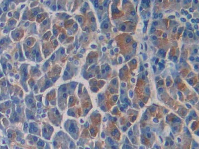 Immunohistochemistry (Formalin/PFA-fixed paraffin-embedded sections) - Anti-SEPT5 antibody (ab233431), expandable thumbnail
