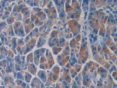 Immunohistochemistry (Formalin/PFA-fixed paraffin-embedded sections) - Anti-SEPT5 antibody (AB233431)