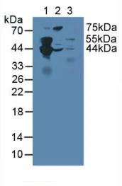 Western blot - Anti-SEPT5 antibody (AB233431)