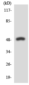 Western blot - Anti-SEPT6 antibody (AB138036), expandable thumbnail