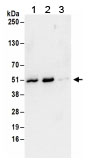 Immunoprecipitation - Anti-SEPT7 antibody (AB186010)