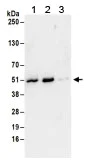 Immunoprecipitation - Anti-SEPT7 antibody (AB186010)