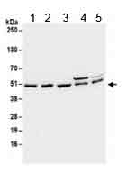 Western blot - Anti-SEPT7 antibody (AB186010)