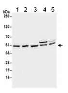 Western blot - Anti-SEPT7 antibody (AB186010)