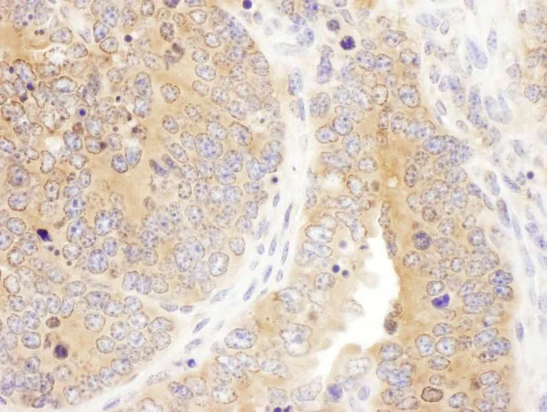 Immunohistochemistry (Formalin/PFA-fixed paraffin-embedded sections) - Anti-SEPT7 antibody (AB186021)