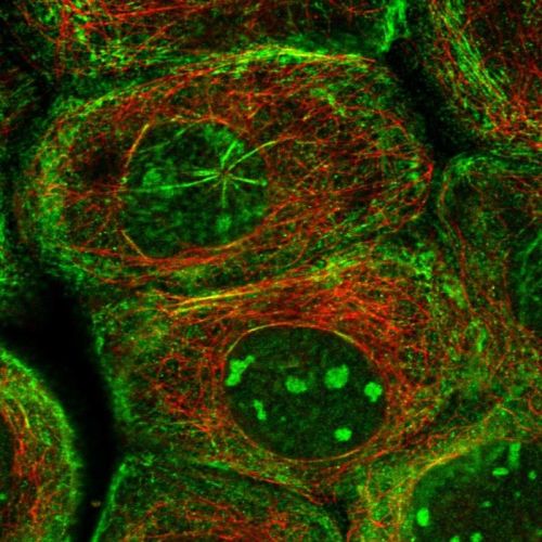 Immunocytochemistry/ Immunofluorescence - Anti-SEPT7 antibody (ab244434), expandable thumbnail