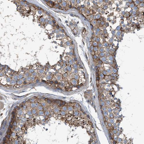 Immunohistochemistry (Formalin/PFA-fixed paraffin-embedded sections) - Anti-SEPT7 antibody (AB244434), expandable thumbnail