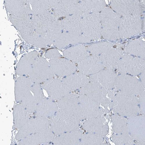 Immunohistochemistry (Formalin/PFA-fixed paraffin-embedded sections) - Anti-SEPT7 antibody (AB244434), expandable thumbnail