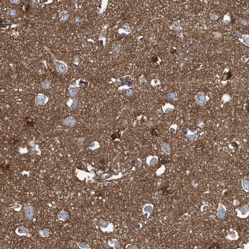 Immunohistochemistry (Formalin/PFA-fixed paraffin-embedded sections) - Anti-SEPT7 antibody (ab244434), expandable thumbnail