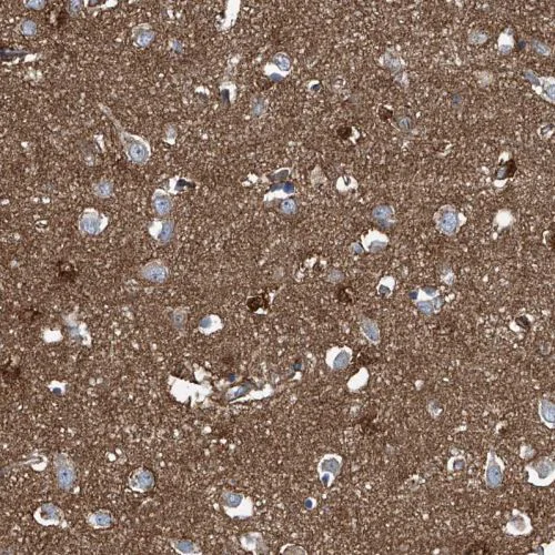 Immunohistochemistry (Formalin/PFA-fixed paraffin-embedded sections) - Anti-SEPT7 antibody (AB244434)
