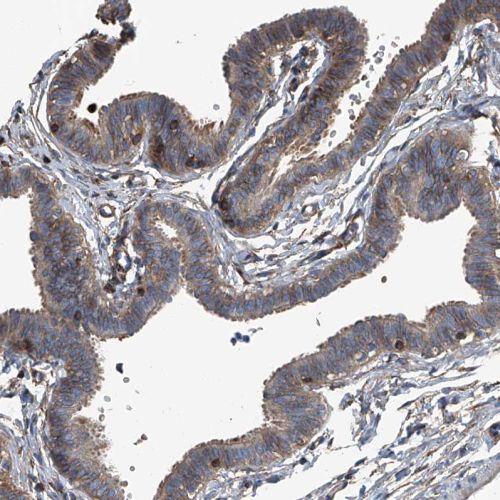 Immunohistochemistry (Formalin/PFA-fixed paraffin-embedded sections) - Anti-SEPT7 antibody (ab244434), expandable thumbnail