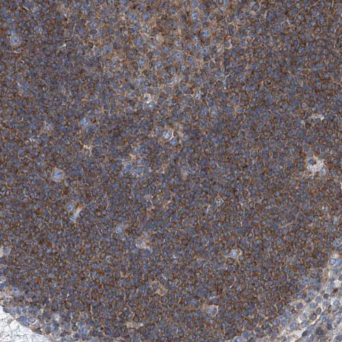 Immunohistochemistry (Formalin/PFA-fixed paraffin-embedded sections) - Anti-SEPT7 antibody (AB244434), expandable thumbnail
