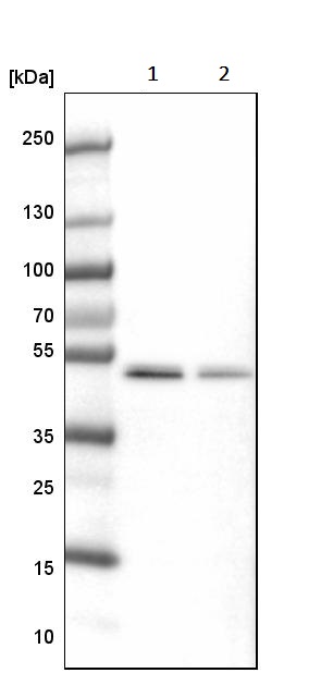 Western blot - Anti-SEPT7 antibody (AB244434), expandable thumbnail