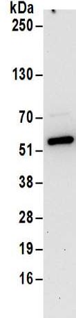 Immunoprecipitation - Anti-Septin 11 antibody (AB183529)