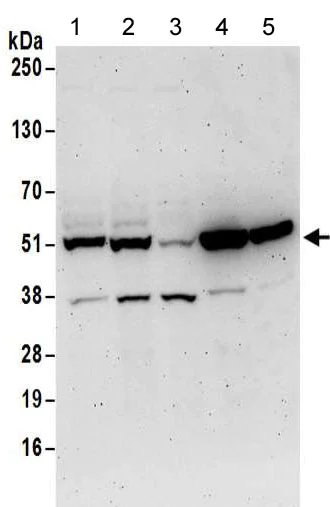 Western blot - Anti-Septin 11 antibody (AB183529)