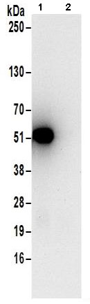 Immunoprecipitation - Anti-Septin 11 antibody - C-terminal (AB183537)