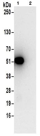 Immunoprecipitation - Anti-Septin 11 antibody - C-terminal (AB183537)