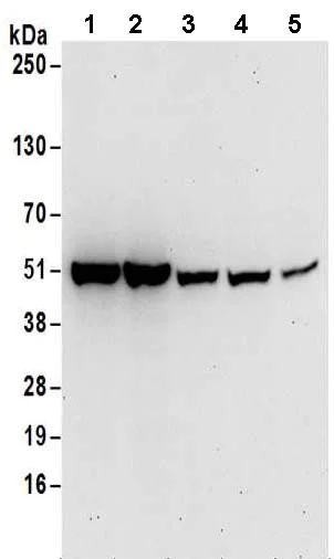 Western blot - Anti-Septin 11 antibody - C-terminal (AB183537)