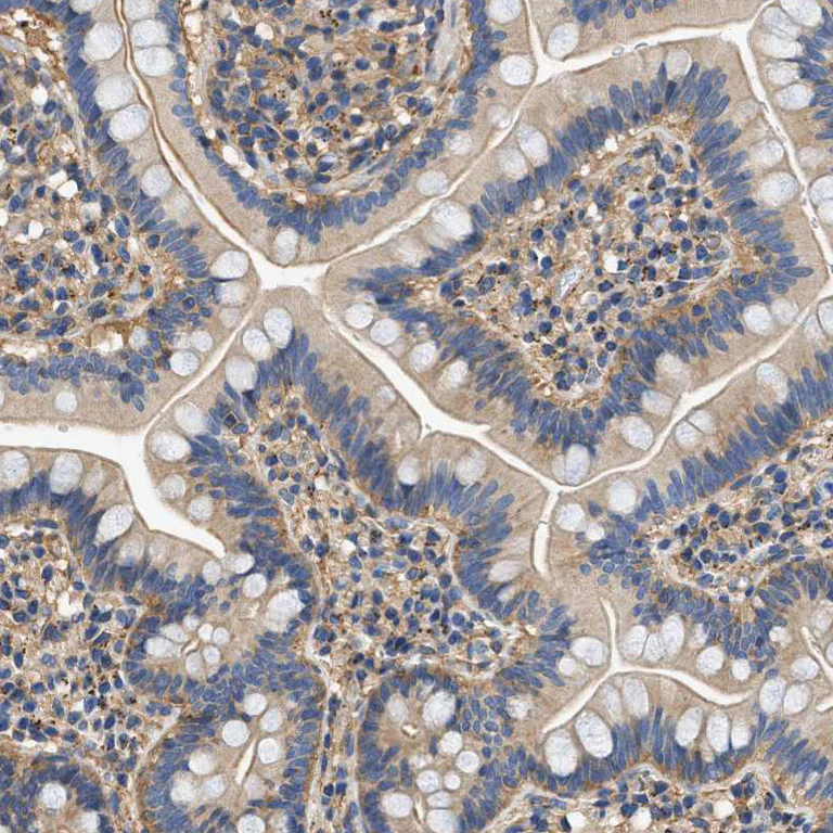Immunohistochemistry (Formalin/PFA-fixed paraffin-embedded sections) - Anti-Septin 2 antibody (AB224410)