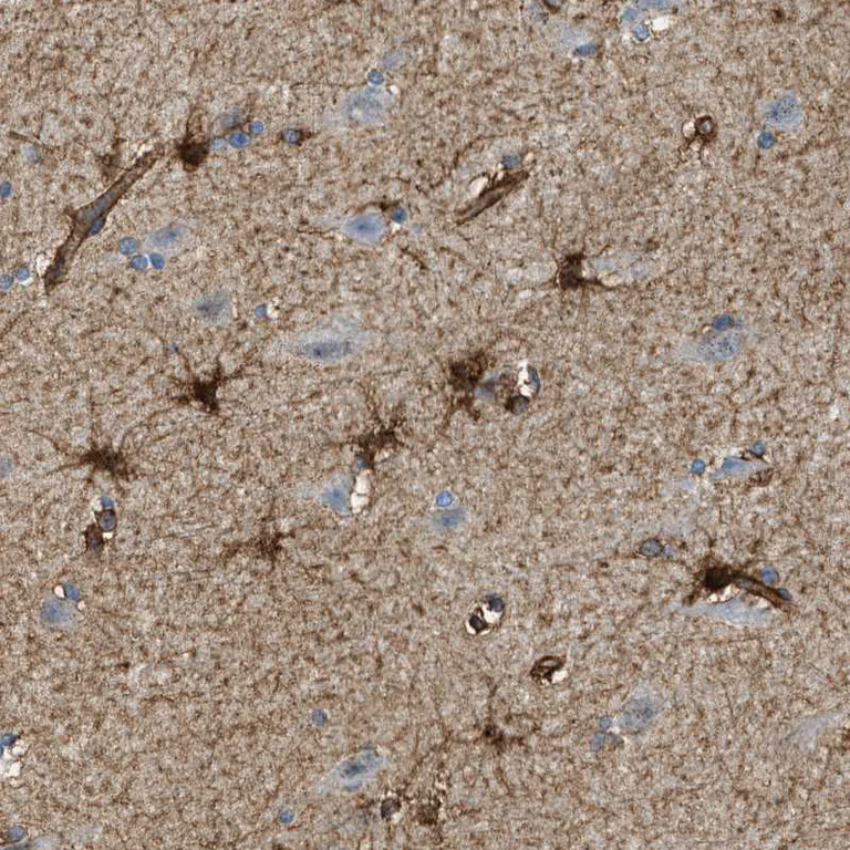 Immunohistochemistry (Formalin/PFA-fixed paraffin-embedded sections) - Anti-Septin 2 antibody (AB224410)