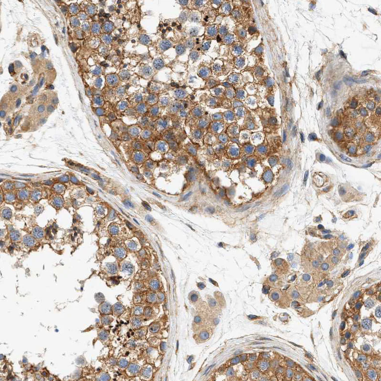 Immunohistochemistry (Formalin/PFA-fixed paraffin-embedded sections) - Anti-Septin 2 antibody (AB224410)